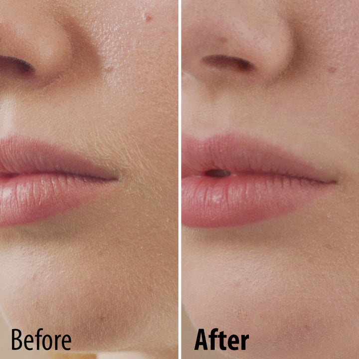 Perfect Face Facial Hair Remover