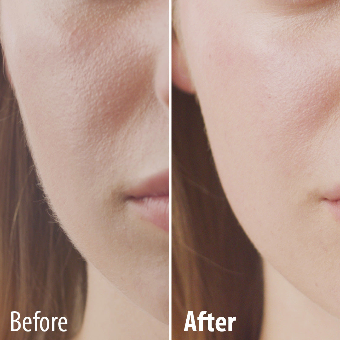 Thin lizzy hair removal Clearance