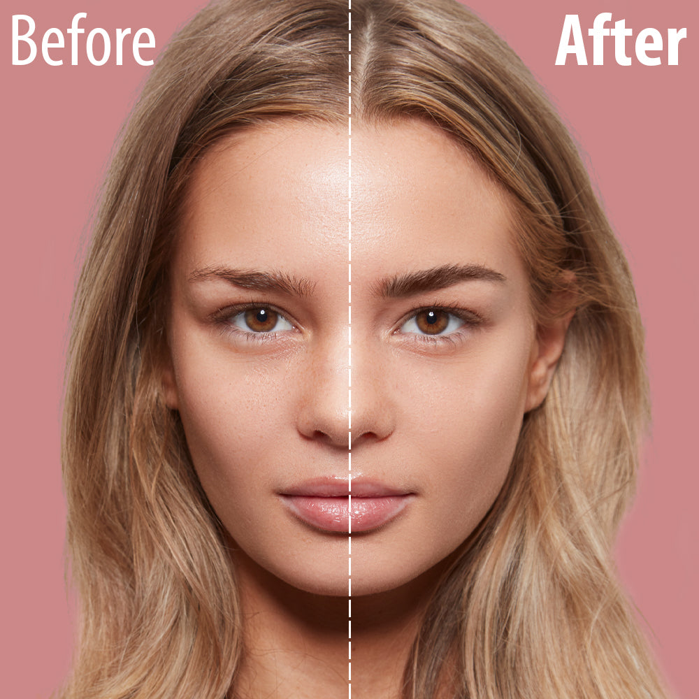 Eyebrow Fillers Before and After