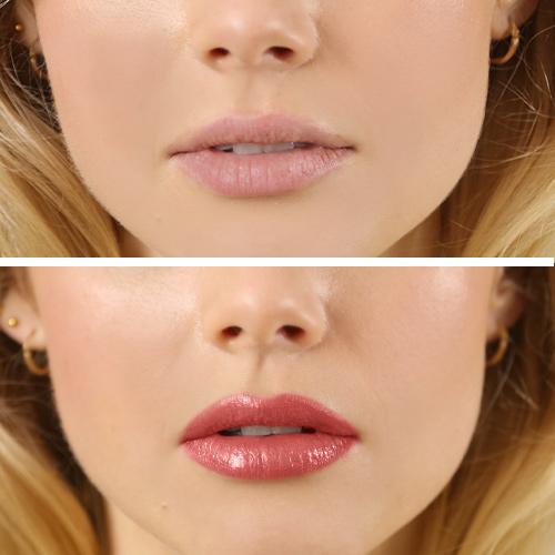 Lipkit Before and After