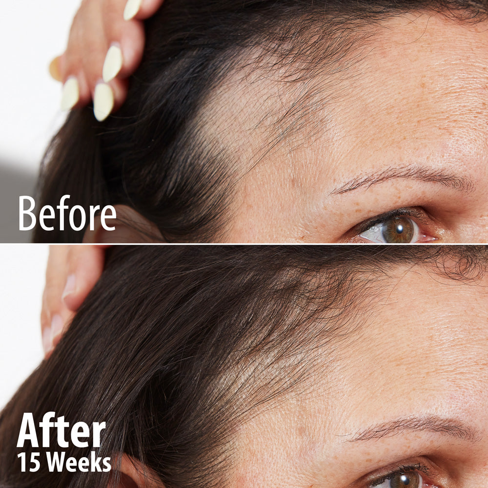 How to Use Concealer to Cover Dark Spots for a Natural Look