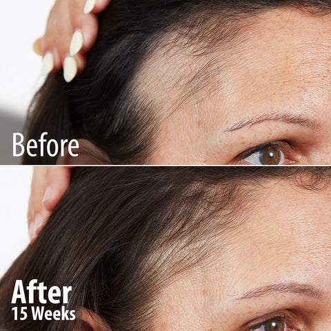 How to Use Concealer to Cover Dark Spots for a Natural Look