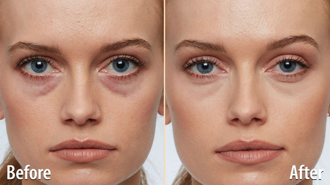 The Best Concealer for Dark Circles in Australia: A Step-by-Step Tutorial to Brighten Tired Eyes