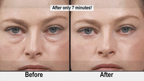 How to Get Rid of Under Eye Bags and Wrinkles in Just 7 Minutes