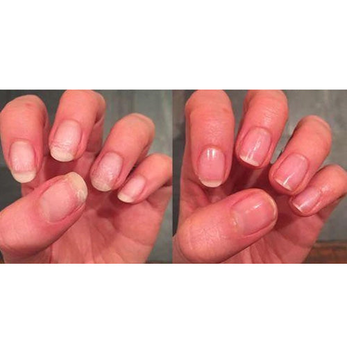 How a Nail Protection Gel for Brittle Nails Can Bring Back the Shine