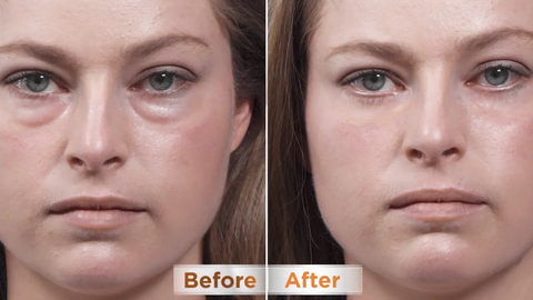 Tired Eyes, Busy Life: How Australians Are Fixing Under-Eye Bags in Minutes