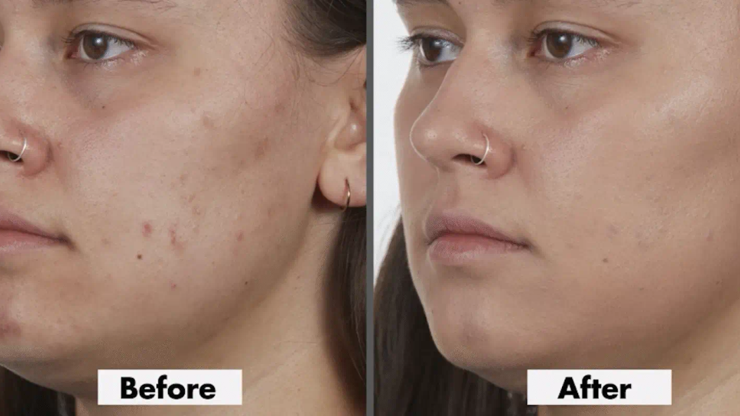 Under Eye Concealer: How to Choose One That Doesn't Crease or Cake