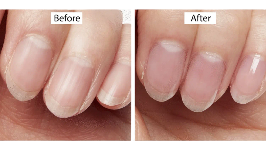 Ridges in Nails: What They Mean & How to Smooth Them