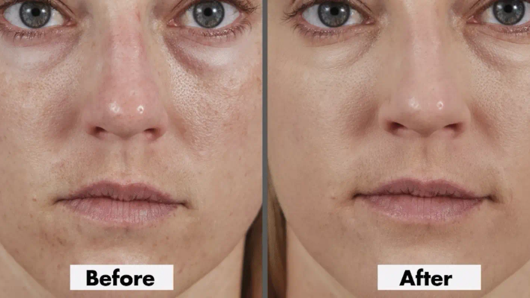 Best Concealer for Dry Skin: Stopping Flaking, Clinging and Patchiness