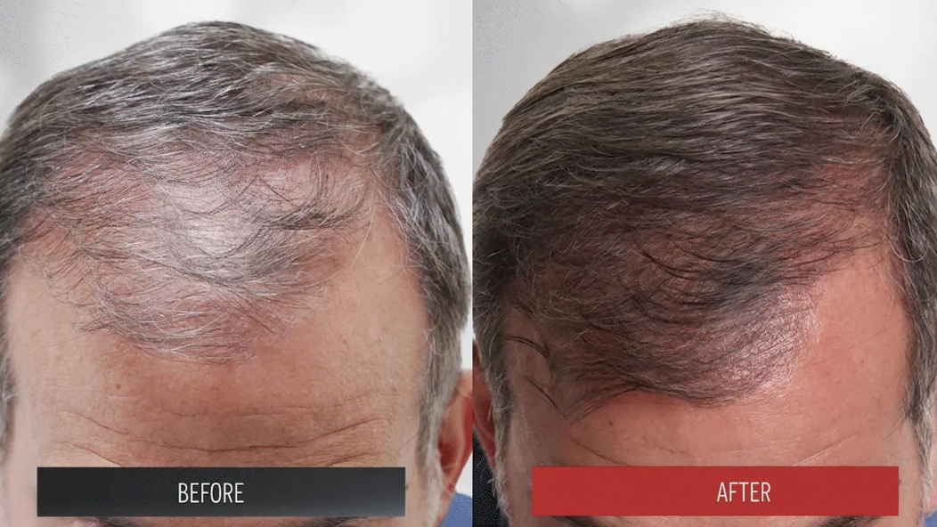 How to Add Volume to Fine Hair