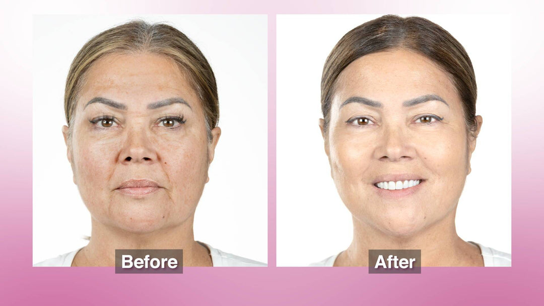 DermaWav