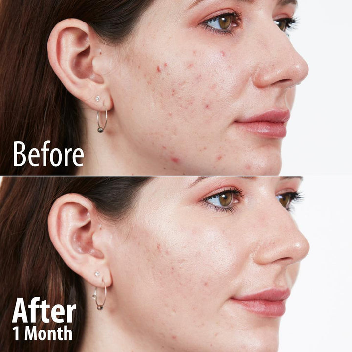 Anti-Aging Starter Kit (Email Offer)