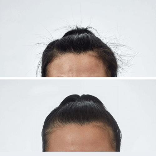 Thin Lizzy Hair Smooth Wand Before and After - Ponytail